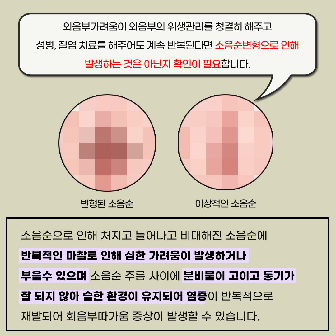 정자역산부인과
외음부가려움
증상이 반복된다면 소음순 변형 의심!