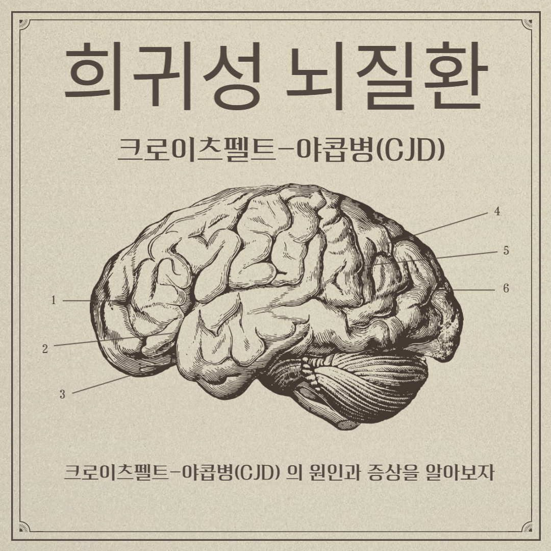  크로이츠펠트-야콥병(CJD)의 원인과 증상 (검사비용지원법)