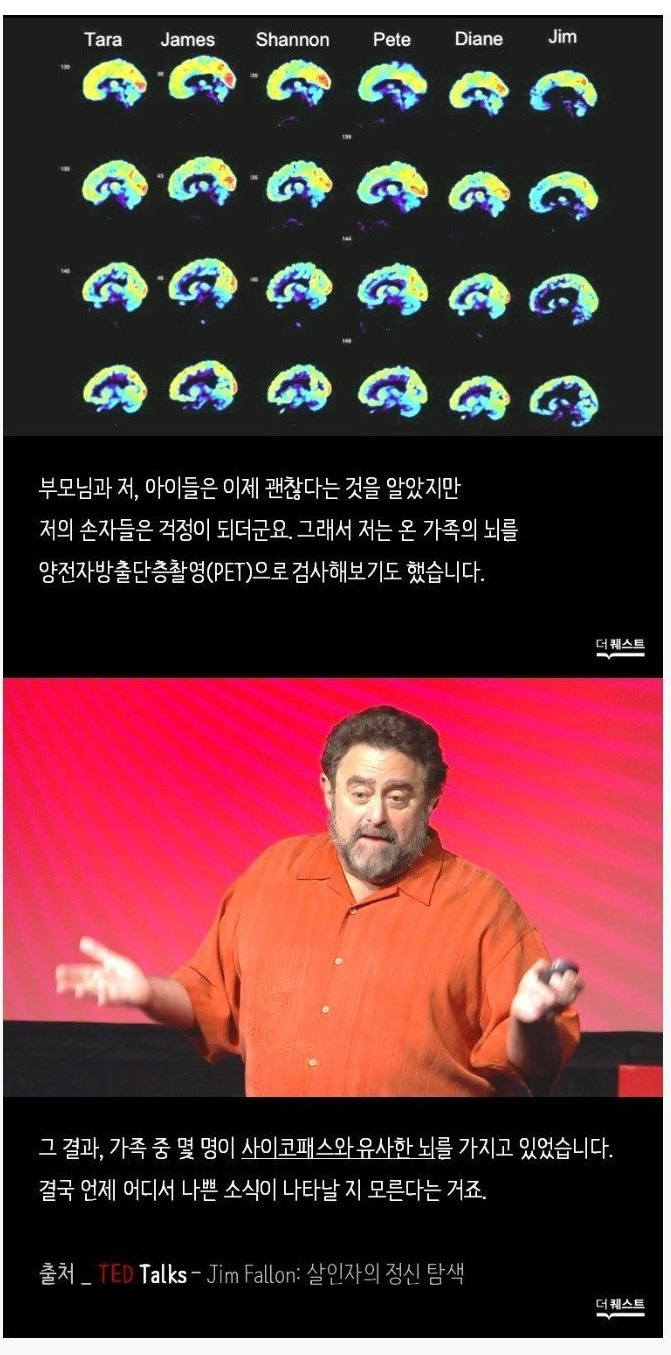 소름 돋는다는 싸이ㅋ패스의 뇌… 5