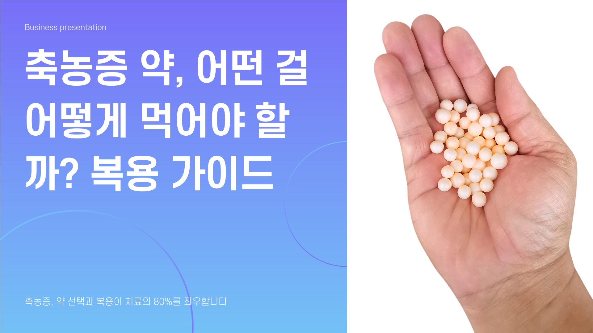축농증 약