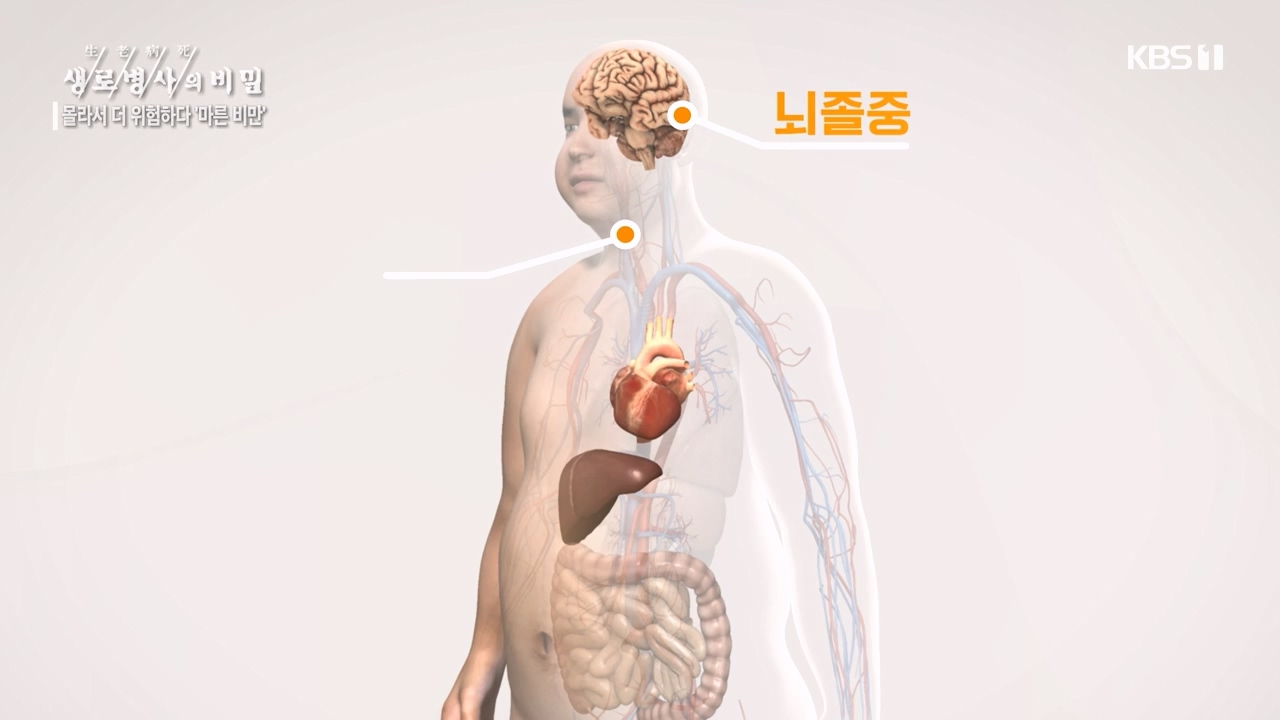생로병사의 비밀.E889.231109p-NEXT.mp4_20231109_203831.872.jpg