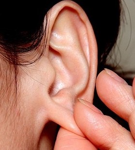귀 피지낭종 알면 간단하게 치료가가능합니다. :: 일상생활 노른자 정보 - 노랑정보 귓볼 피지 낭종<몽우리>” style=”width:100%” title=”귓볼 피지 낭종<몽우리>“><figcaption>귓볼 피지 낭종<몽우리></figcaption></figure>
<figure><img decoding=
