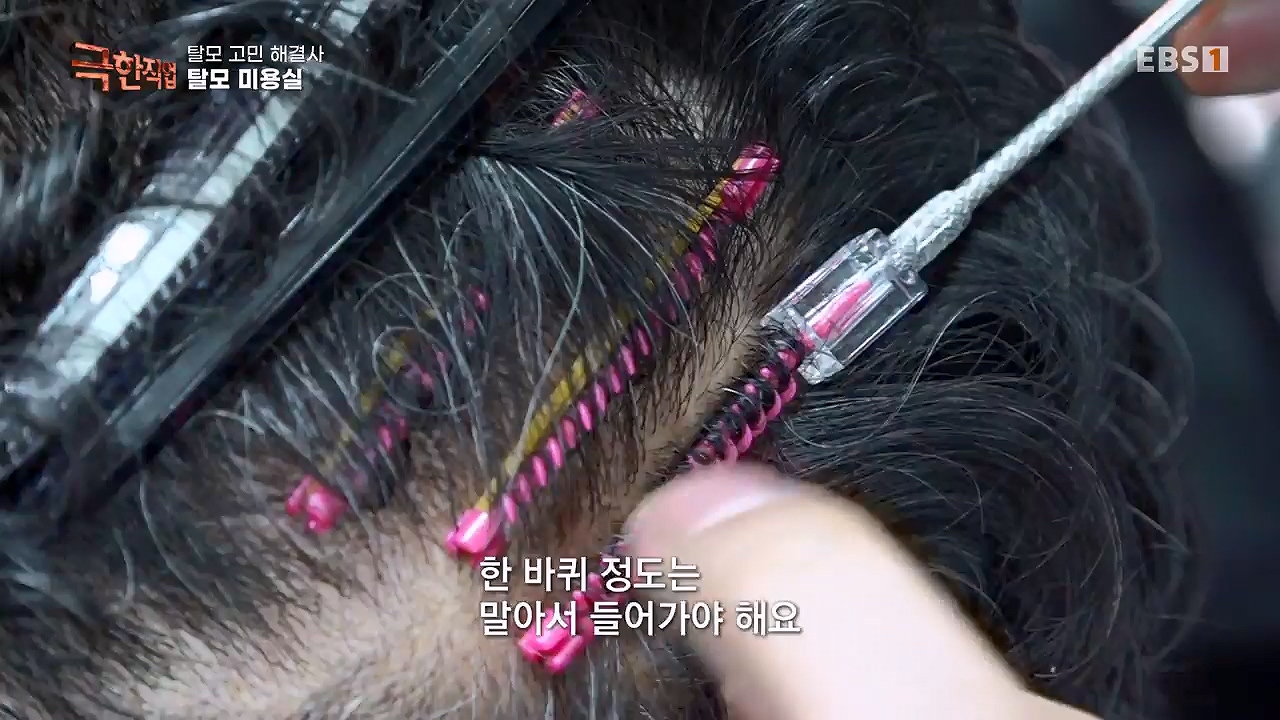 TV - 전 국민의 평생학교 EBS탈모 고민 해결사.mp4_20230508_195811.374.jpg