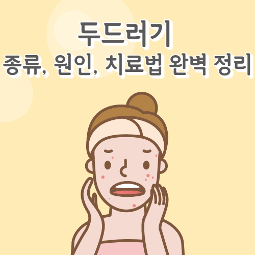  두드러기 종류, 원인, 치료법 완벽 정리