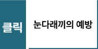 눈다래끼 예방