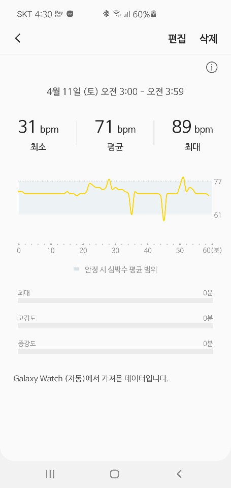  부정맥 자가 진단 및 관리
