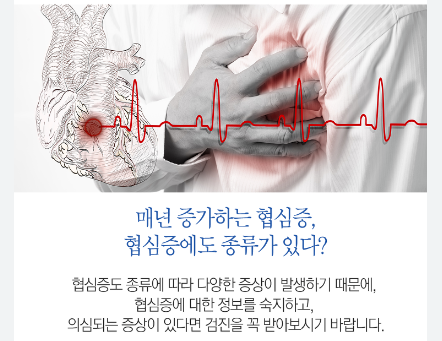 변형 협심증