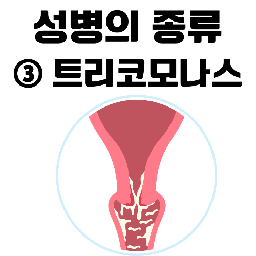 트리코모나스, 성매개 감염, 성병, 트리코모나스 바지날리스, 질염, 성적 접촉, 전파 경로, 감염 증상, 여성 증상, 남성 증상, 질 분비물, 배뇨 시 통증, 성교 시 통증, 요도 분비물, 무증상 감염, 질 분비물 검사, 신속 검사, PCR 검사, 항생제 치료, 메트로니다졸, 티니다졸, 파트너 치료, 알코올 섭취 금지, 합병증, 예방 방법, 라텍스 콘돔, 안전한 성관계, 성병 예방, 조기 양막 파수, 조산, 정기적인 성병 검사