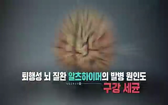 [792회] 생로병사의 비밀 - KBS[세균의 습격, 당신의 잇몸을 지켜라!] 감기보다 병원을 더 자주 찾게 만드는 질병이 있다. 바로 치주질환이다. 2020년 외래 다빈도 질병 1위를 차지한 치은염 및 치주질환 환자는 1,637_20220505_135817.980.jpg