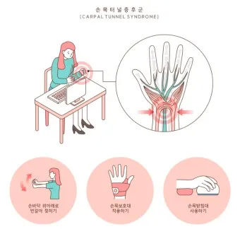 거북목 증상 치료법 스트레칭_26