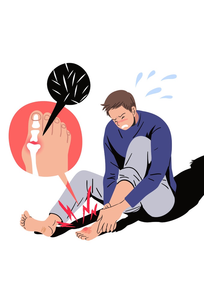  통풍 증상과 원인 알고 예방하자.