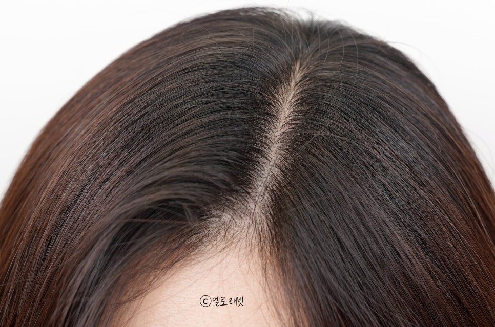 ts 탈모샴푸 이번엔 2