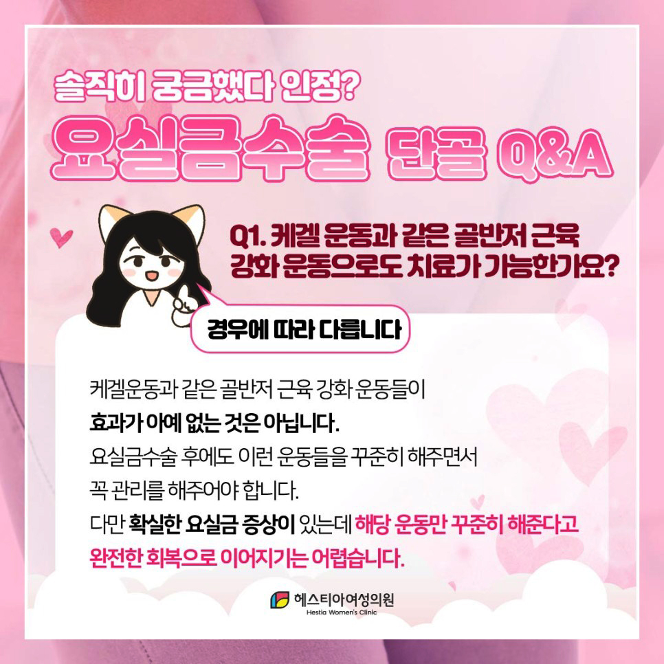 복압성요실금 케겔 운동만으로도 치료가 가능해요?