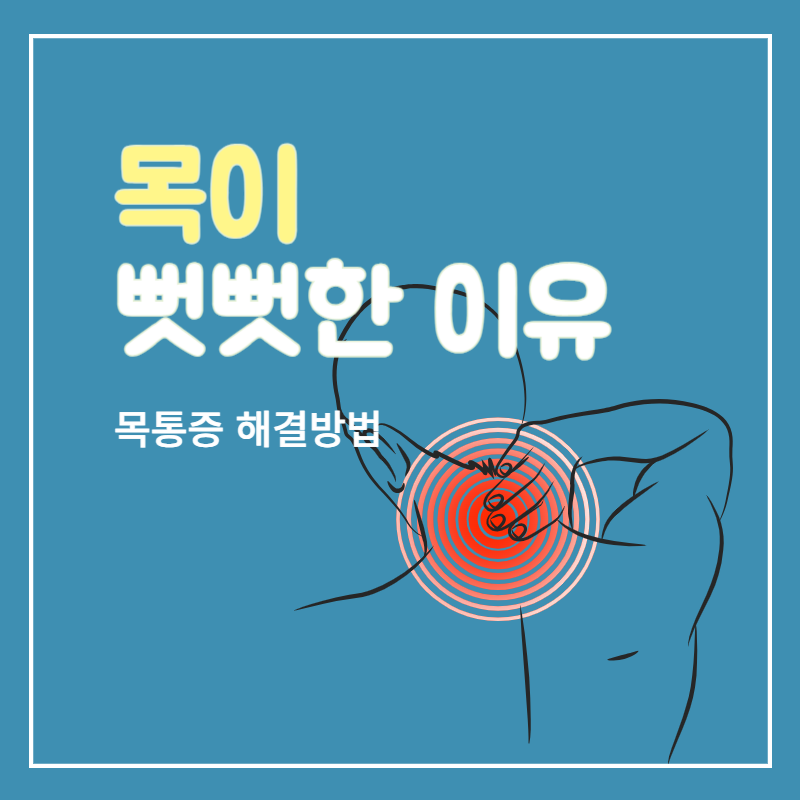 목이_뻣뻣한_이유