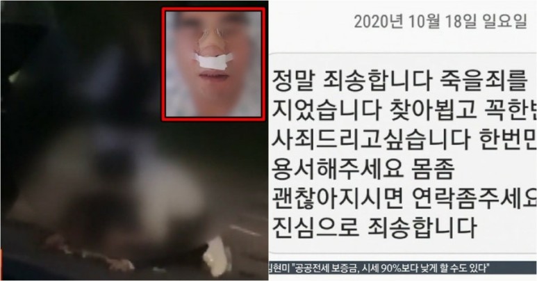  요청 대리기사 코뼈 골절 폭행 - 울산 남구 현금 결제 요청 대리기사 코뼈 머리 골절 폭행남 쌍방폭행 주장