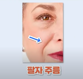  얼굴 팔자주름 없애는 치료방법