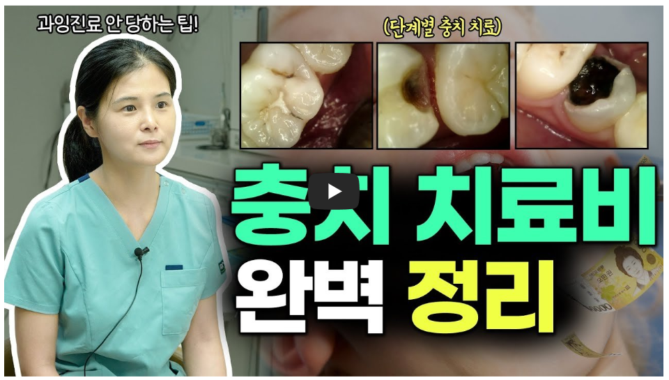 충치 치료 비용 정보 유튜브 이미지