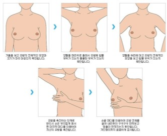 유방암 자가진단 설명 사진