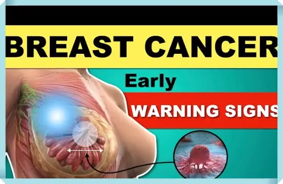 유방암 초기증상