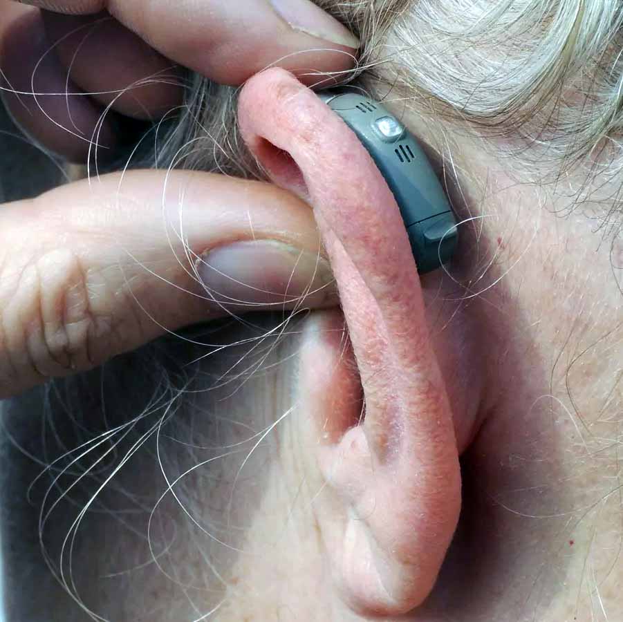 hearing loss and dementia