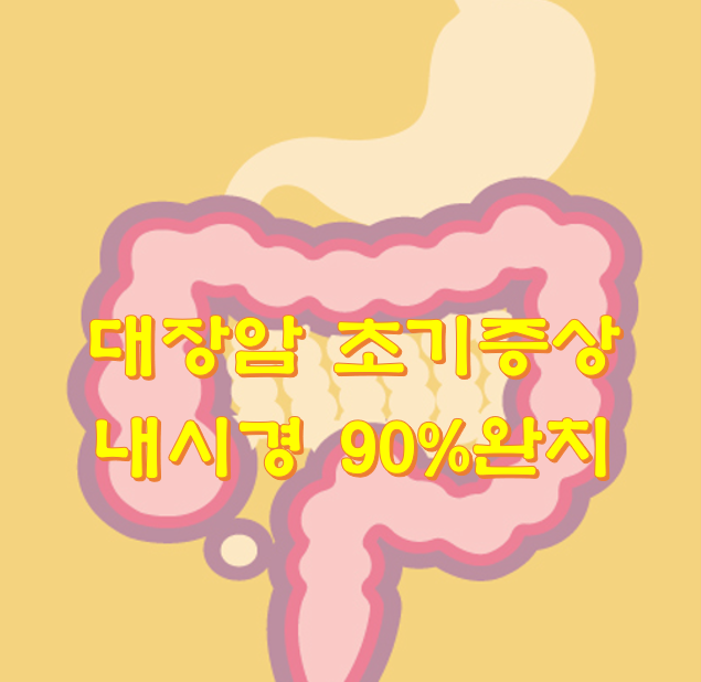  대장암 초기증상 내시경 90%완치