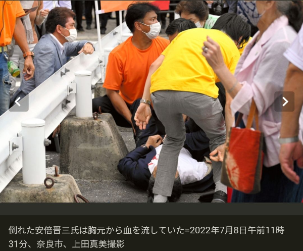 아베 심폐 정지 - 사망 위험 속보에 대한 일본인들의 여론 반응