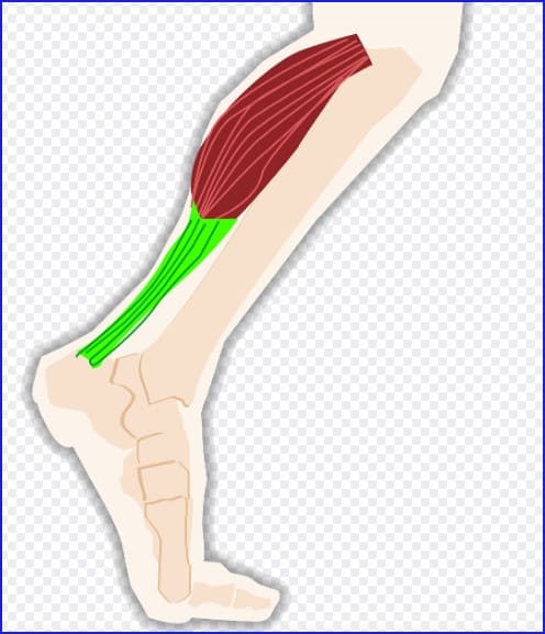 종아리 부종과 근육통