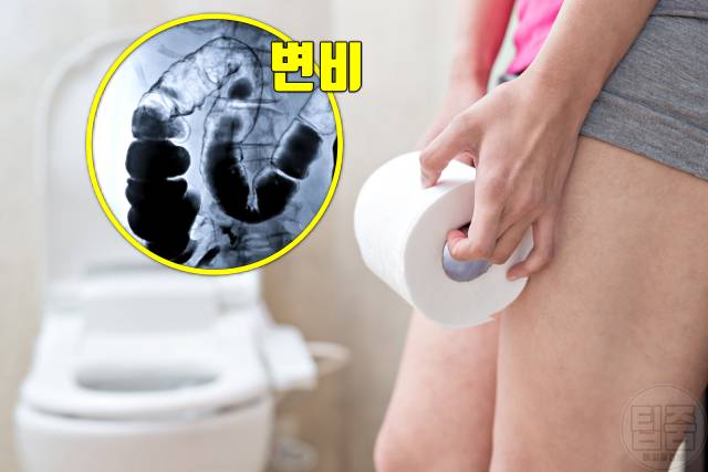 위 같은 통증 게실염 증상 변비 설사