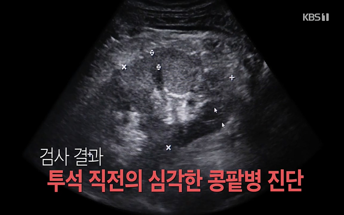 생로병사의 비밀.E819.220421p-NEXT.mp4_20220421_190850.636.jpg