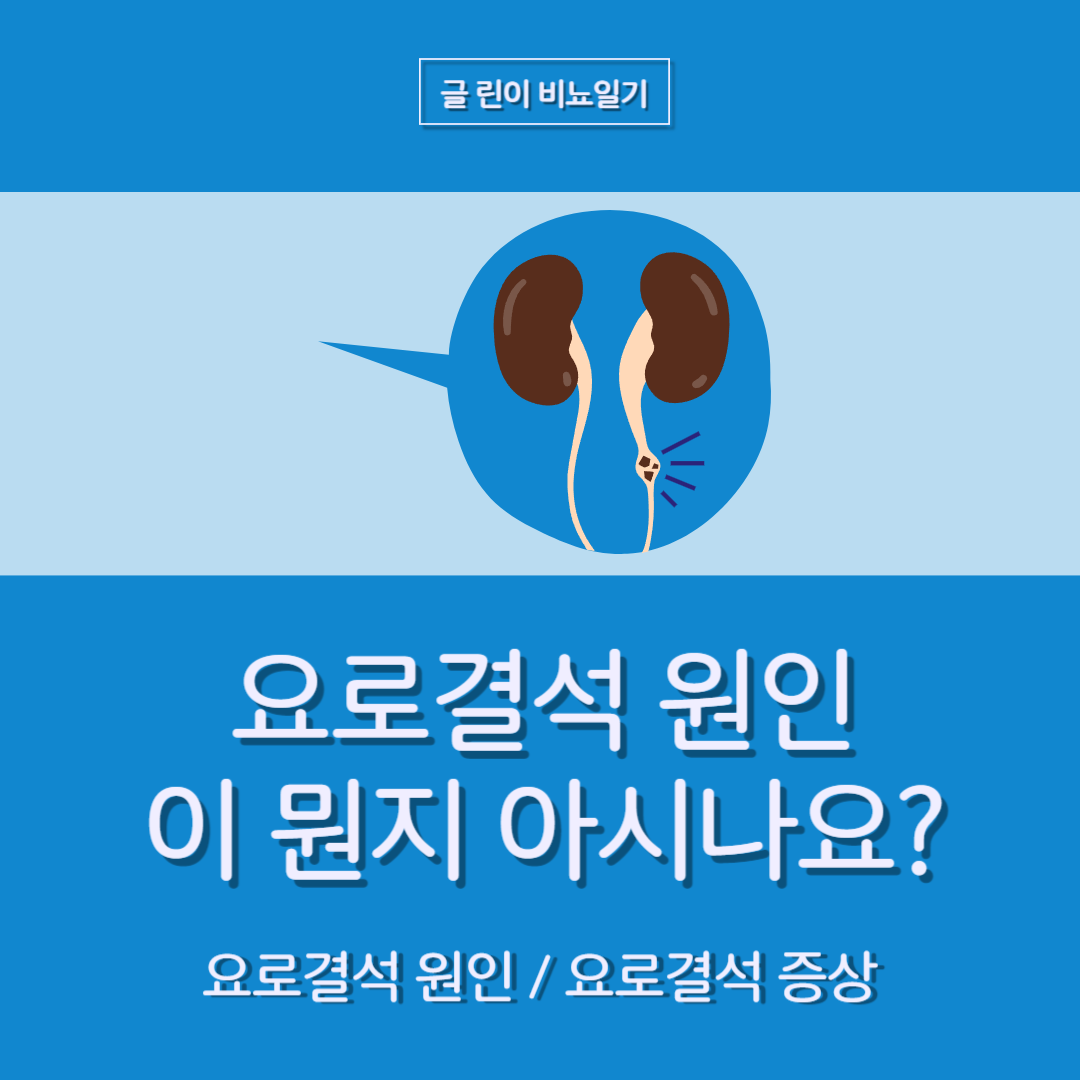  요로결석 원인이 뭔지 아시나요?