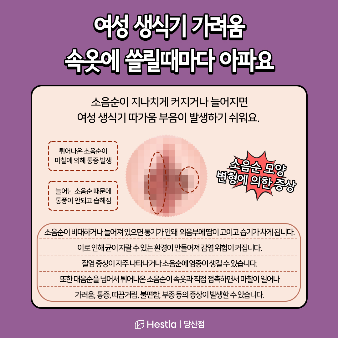 여성 생식기 가려움 너무 가려워요...