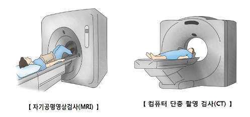 뇌졸중(뇌출혈)원인&#44;초기증상&#44;복용하는약&#44;알티지오메가3