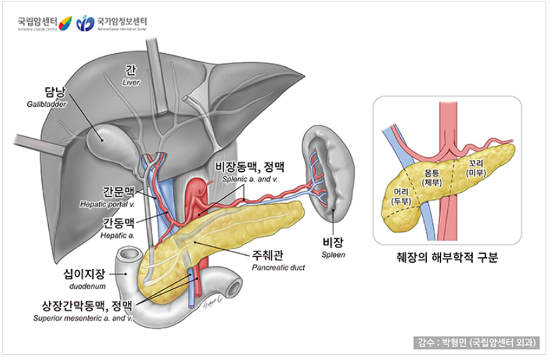 췌장암 초기증상, 3기 4기 완치율 및 암보험금 청구사례