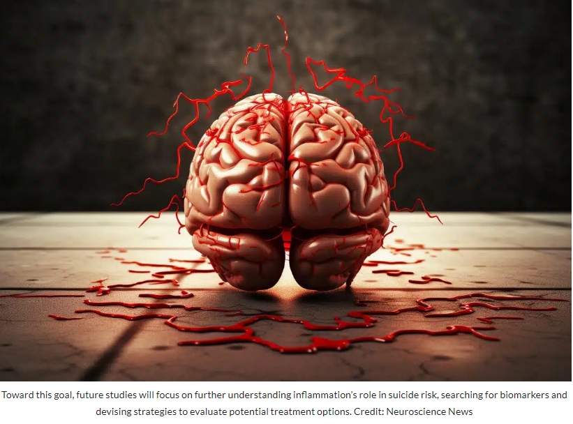 자살한 사람의 뇌상태는? Brain Inflammation Linked to Suicide Risk