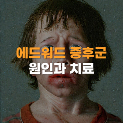 에드워드증후군 치료&#44; 증상&#44; 원인&#44; 검사&#44; 낙태