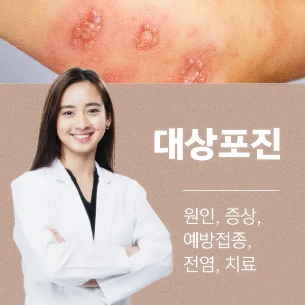 대상포진 원인&amp;#44; 증상&amp;#44; 예방접종&amp;#44; 전염&amp;#44; 치료