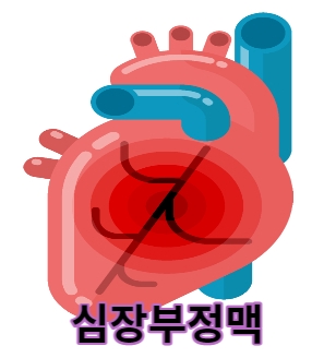 심장부정맥