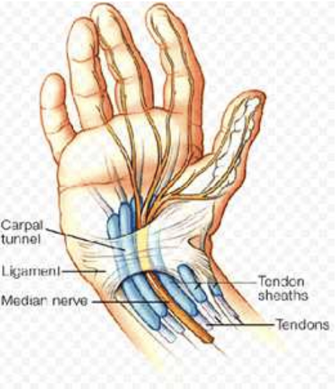 손목 터널 증후군&#44;CTS&#44; 손목 통증