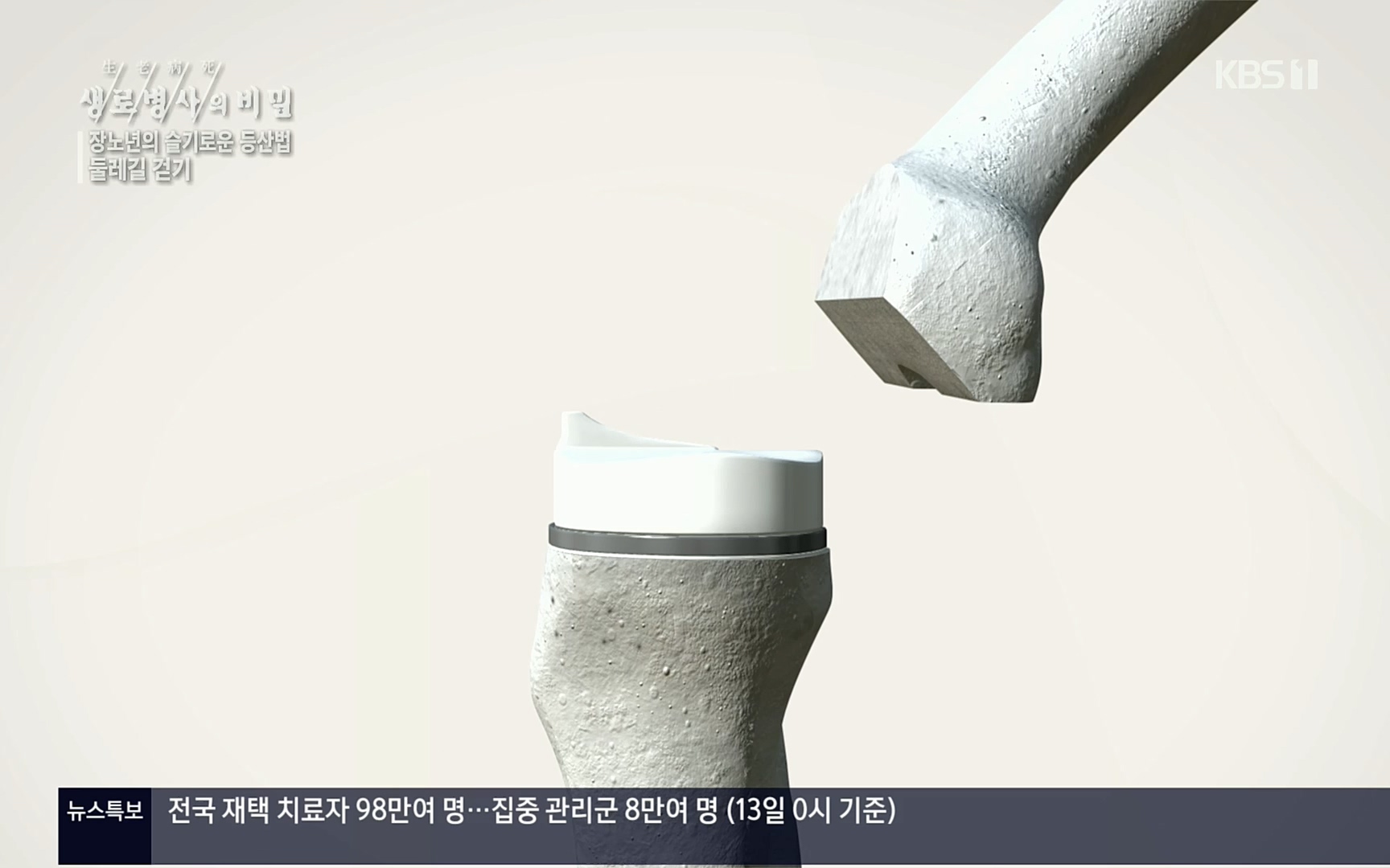 생로병사의 비밀.E816.220413p.H264-F1RST.mp4_20220414_192709.141.jpg