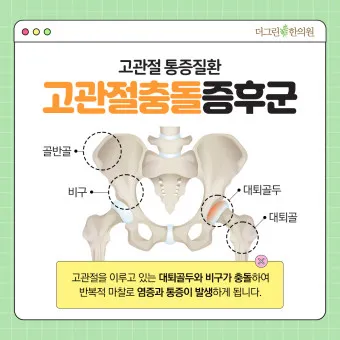 고관절 통증 증상 확인하기_4