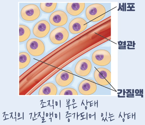 나도 모르게 멍이 드는 이유와 7
