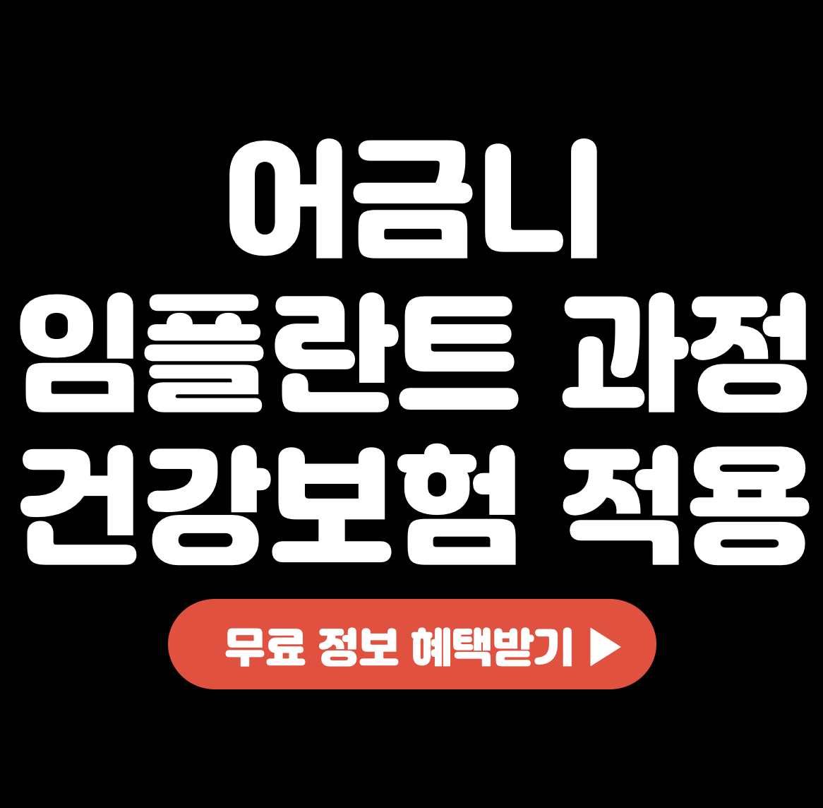 This is 어금니 임플란트 과정&#44; 치료기간&#44; 건강보험 적용 대상