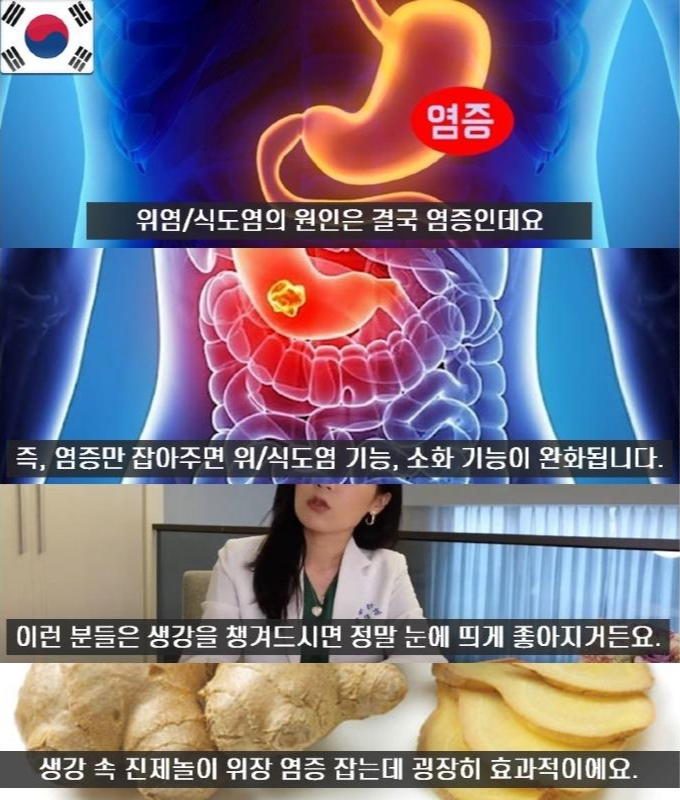 생강 효능