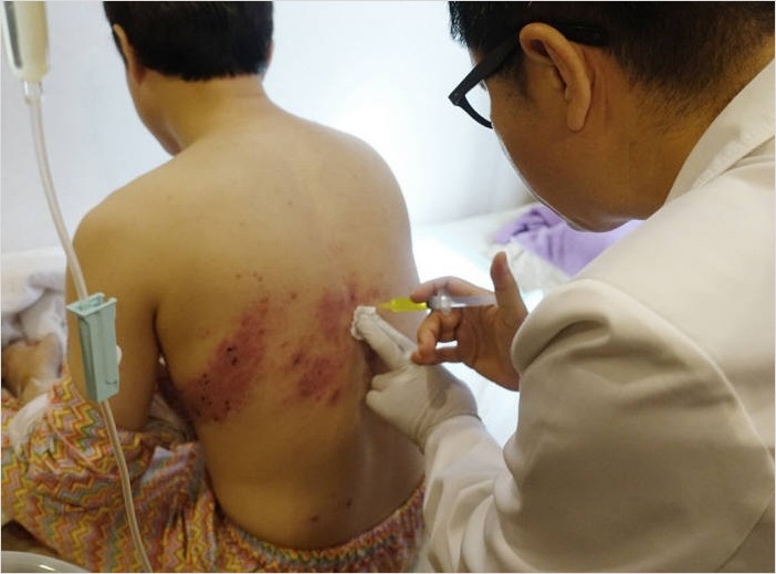  산재 직업병 산재보상 신청방법