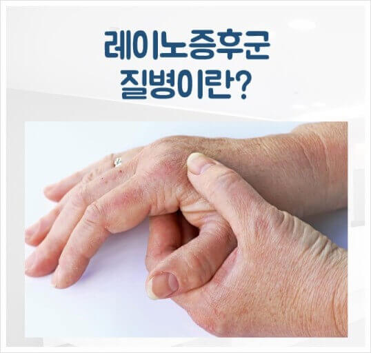 레이노 증후군(레노 증후군)은 손이나 발가락의 혈류가 나빠지고, 손의 색이 하얗게 변하거나 푸르게 변색 되었다가, 그 후 혈류가 돌아오면 붉어지는 상태입니다.