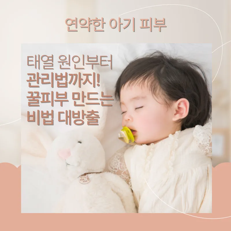 아기 태열 원인 및 관리법