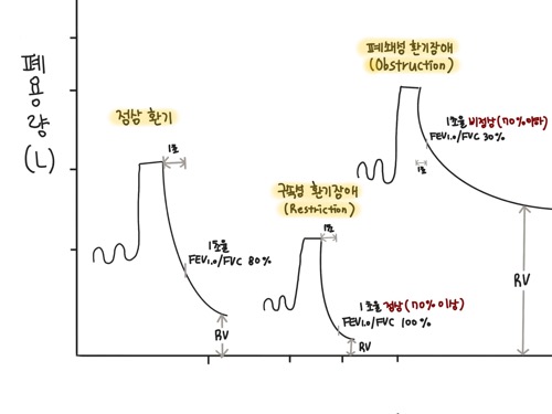 노력성 호기곡선