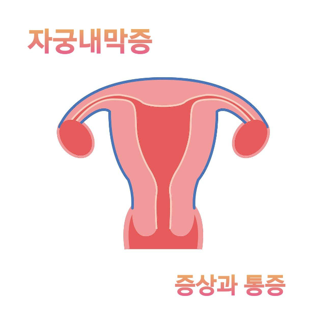 자궁내막증증상과통증 글자와 자궁그림