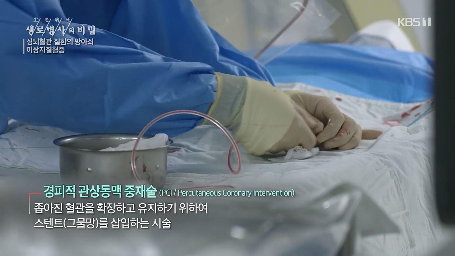 생로병사의 비밀.E862.230329p.H264-F1RST.mp4_20230330_201337.585.jpg