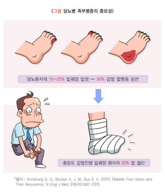 당뇨병에대한 이해를 도우기위한 당뇨발에 대한 이미지